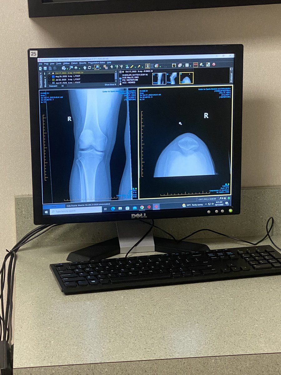IBleedOrange05's tweet photo. @MarkNagi Tore my ACL celebrating https://t.co/KHCwMMqT8G