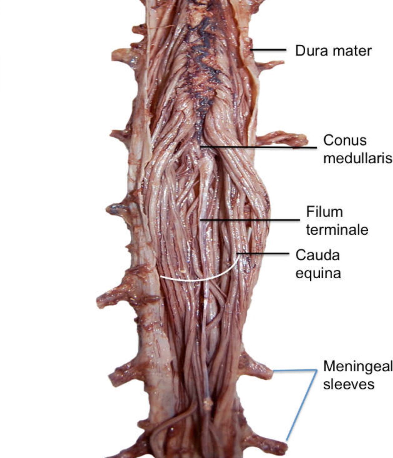 Cauda equina анатомия