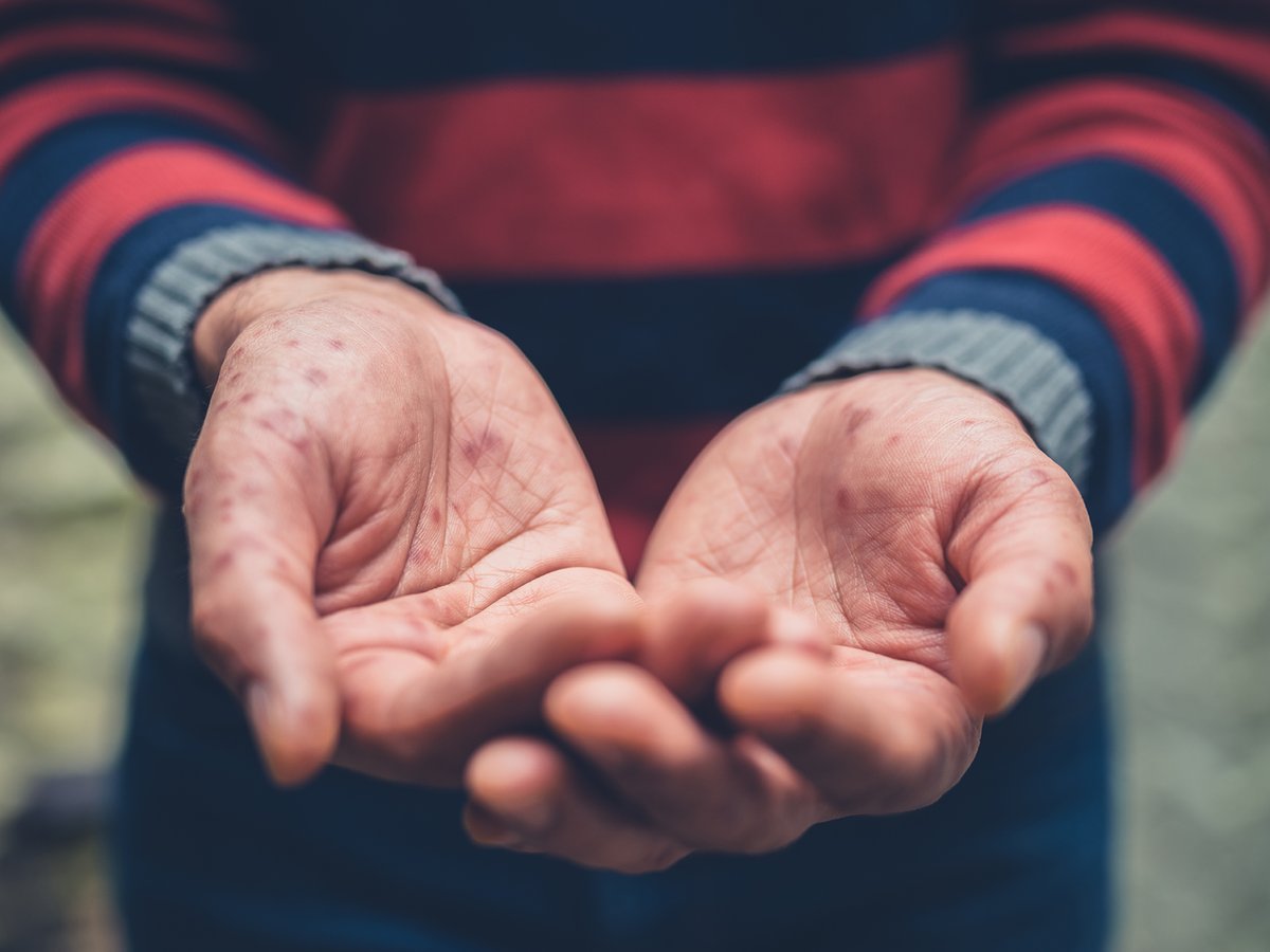 Young and Homeless in Rural America
harfordcaa.org/young-and-home…

#Homeless #HomelessnessAwareness #HomelessnessPrevention #RuralAmerica #America #Rural #Country #FindingShelter #FindingHelp #HomelessShelter