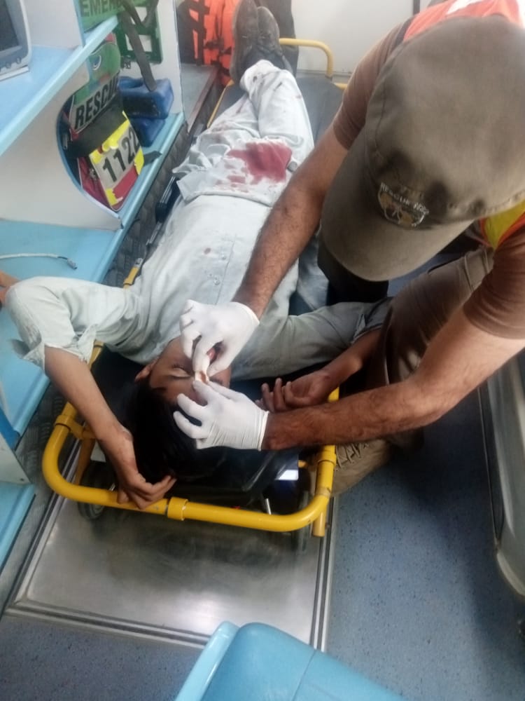 Rescue1122Buner's tweet photo. ریسکو 1122بونیر.،

17.ستمبر  2022

بونیر: ایلٸ کے قریب موٹر سائیکل سلپ ہونے کیوجہ سے1 شخص زخمی، ریسکیو 1122

بونیر: کنٹرول روم بونیرکو اطلاع ملتے ہی میڈیکل ٹیم پوری جائے وقوعہ پر پہنچ گئے۔

بونیر: ریسکیو 1122 کے جوانوں نے زخمی شخص کو ڈی ایچ کیو ہسپتال ڈگر  منتقل کر دیا۔ https://t.co/h5Lf149bzx