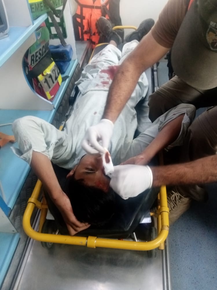 Rescue1122Buner's tweet photo. ریسکو 1122بونیر.،

17.ستمبر  2022

بونیر: ایلٸ کے قریب موٹر سائیکل سلپ ہونے کیوجہ سے1 شخص زخمی، ریسکیو 1122

بونیر: کنٹرول روم بونیرکو اطلاع ملتے ہی میڈیکل ٹیم پوری جائے وقوعہ پر پہنچ گئے۔

بونیر: ریسکیو 1122 کے جوانوں نے زخمی شخص کو ڈی ایچ کیو ہسپتال ڈگر  منتقل کر دیا۔ https://t.co/h5Lf149bzx