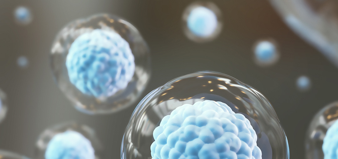 El Dr. Pedro Guillén afirma que el #cáncer va a pasar a la historia gracias a la #terapiacelular. Su opinión provocadora nace del concepto de la célula como #medicamento y pieza fundamental para curar las dolencias de los seres humanos.

acortar.link/vGaIma