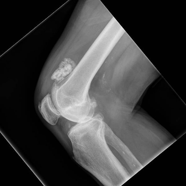 Large Inside Of Knee