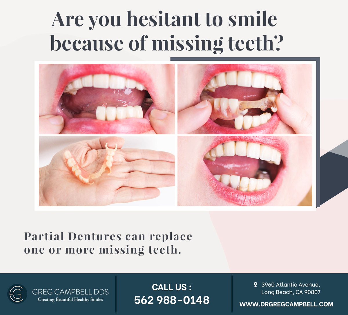 DdsCampbell's tweet photo. Partial dentures replace single or multiple missing teeth and improve your ability to eat and speak clearly. Schedule a consultation at https://t.co/CSqdLM8mlF, and we'll create #partialdentures that suit your individual needs. #gregcampbelldds #longbeach #CA https://t.co/pKVk9Yfan8