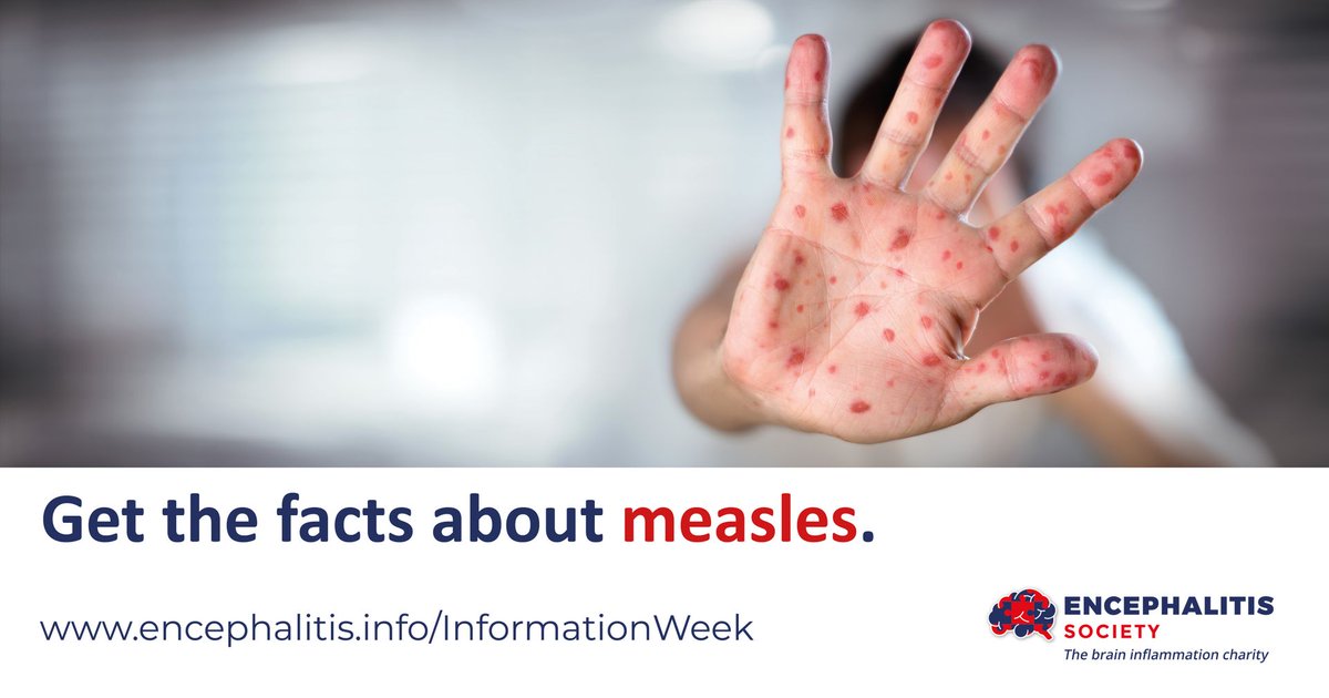 encephalitis's tweet photo. Are you looking to get the facts about measles?
To mark #EncephalitisInfoWeek - we have put together some information about measles, its symptoms and how it can be prevented.
Visit https://t.co/vMlZDPaRYo https://t.co/QhSCJtsjbq
