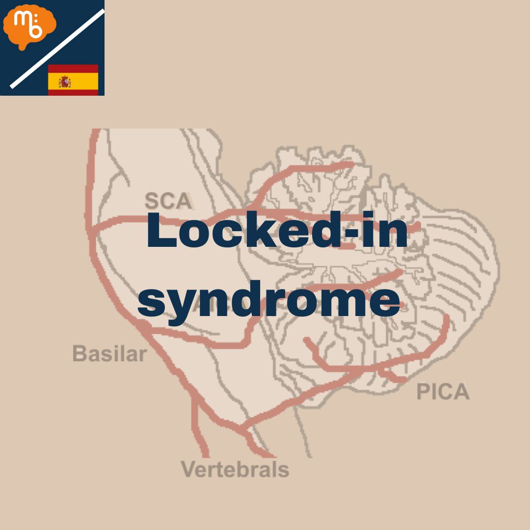 Mission:Brain Complutense tweet media