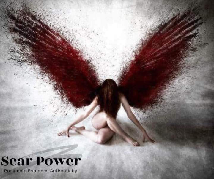 scarpowerco's tweet photo. “They witnessed your descent, now let them watch your rising.”
-Scar Power
Learn more at https://t.co/xQm1g2pNN4
#scarpower #scarsarebeautiful #freedom #womenempowerment #womenempoweringwomen #RiseandShine https://t.co/d32ZoEi1zV
