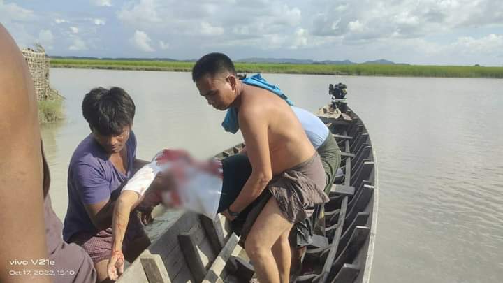 17.10.2022
Myanmar terrorist army
shooting big guns into the Min Bya city and villages.
So , 10 civilians are injures 
and some dead in the Min
Bya Township , Rakhine
State . Pleases , watch
world and UN .