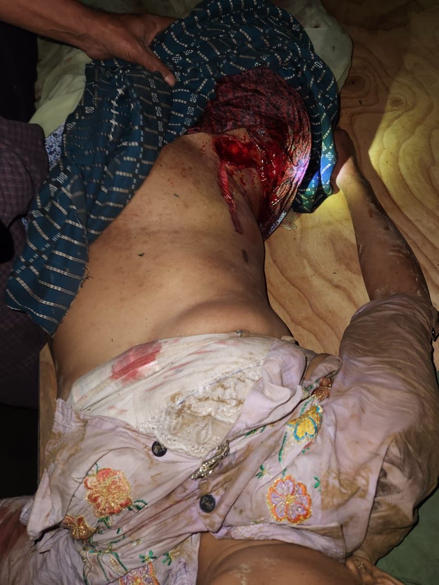 BREAKING:  Today evening, Junta Forces fired heavy weapons into the villages nearby Kisapanadi bridge in Kyauktaw Township, Rakhine State. Rohingya villagers’ properties, including an ambulance, were partially destroyed. 1/2

#WhatshappenininMyanmar