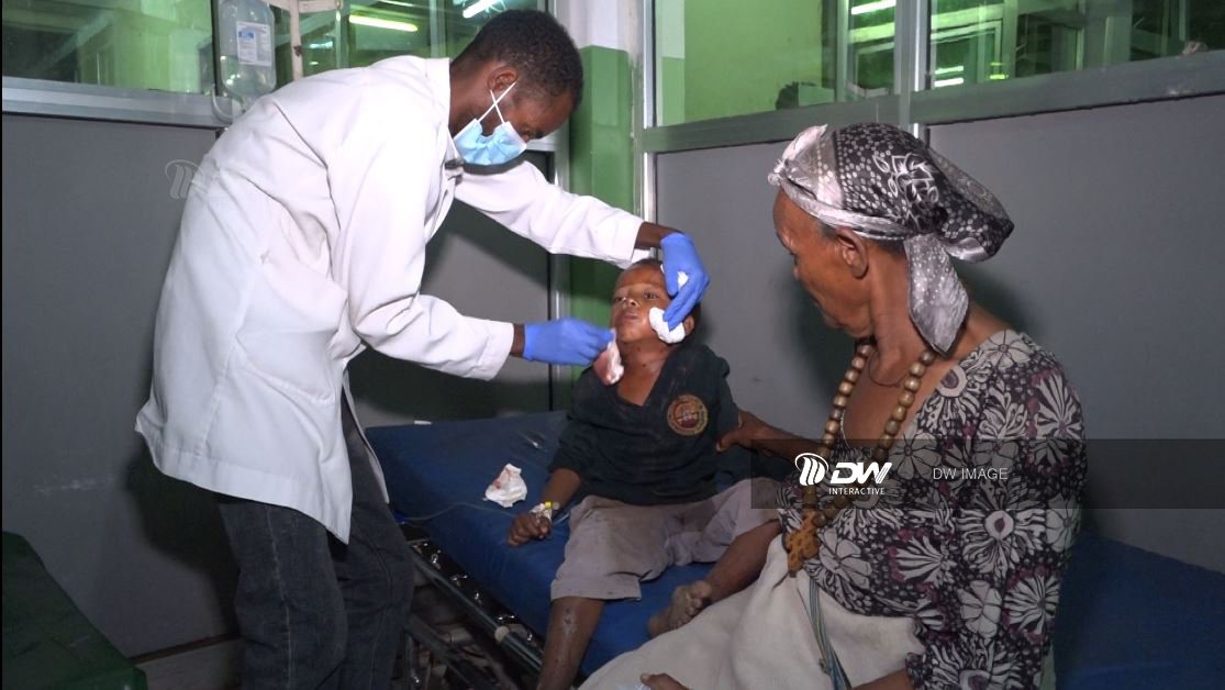 Tmhtvnews's tweet photo. Breaking news: .#Ethiopian Air Force #Bombed the town of #Alamata this morning 10/17/2022. the attack was conducted in a residential area, causing injury and Killing of several civilians. https://t.co/sCXJ7zmzcP