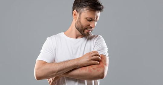 PemfSupply's tweet photo. PEMF therapy can reduce inflammation and help to minimize your flare-ups with psoriasis. Visit our educational website to learn more. https://t.co/Xctn73f1Sx