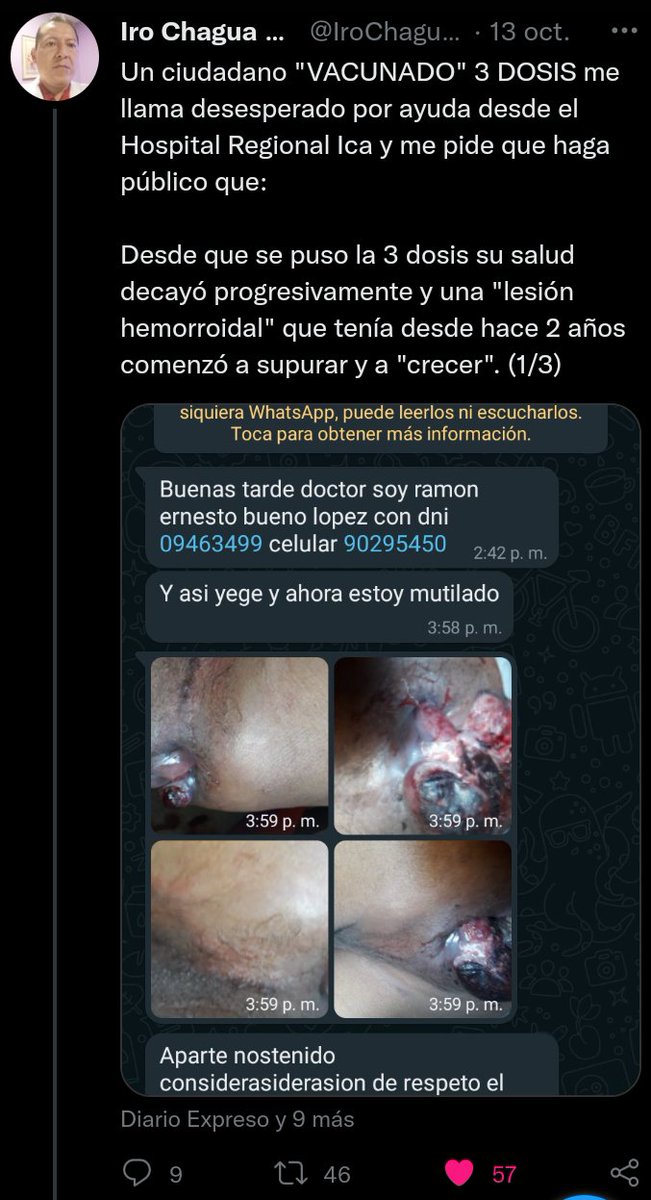 UN EFECTO ADVERSO DE LA "VACUNA" ES CANCER según la FDA y PFIZER.

Pueden constatarlo en la página de la Asociación que lidera el Dr McCullough:

phmpt.org/wp-content/upl…

Aquí un caso de una persona vacunada 3 DOSIS y con DIAGNÓSTICO presuntivo de CANCER.(1/2)

c.c. <a href="/blogdenotas/">Bruno Ortiz B. (Blogdenotas) </a>