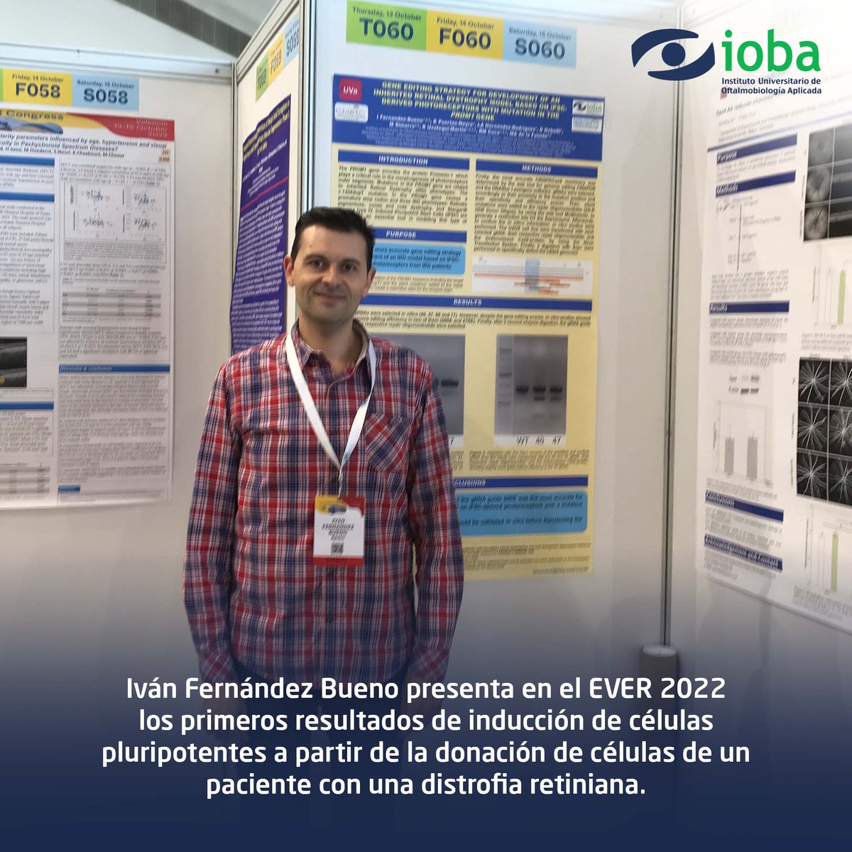 IobaUVa's tweet photo. Iván Fernández Bueno, director de I+D del @IobaUVa, presenta en el #EVER2022 los primeros resultados de inducción de #CélulasPluripotentes a partir de la #DonaciónDeCélulas de un paciente con una #DistrofiaRetiniana. Los primeros pasos para implantar la #TerapiaGénica en el IOBA. https://t.co/yCmPAl35Nk