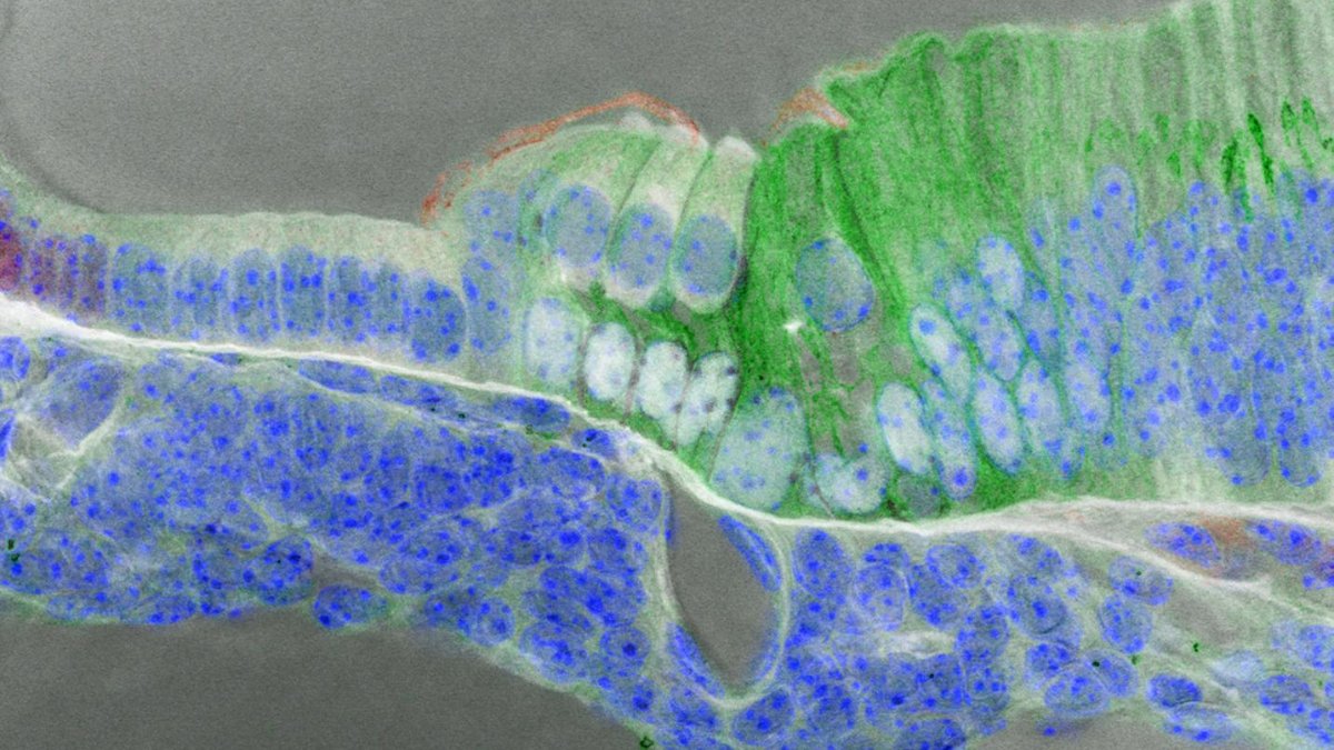 NIH NIDCD (@nih_nidcd) on Twitter photo #SciArt for #NPYHM: Section of an embryonic mouse inner ear.
📷 #NIDCDgrantee Drs. Brent Wilkerson, Taha Jan, & Mirko Scheibinger, <a href="/StanfordMed/">Stanford Medicine</a> #SciArt for #NPYHM: Section of an embryonic mouse inner ear.
📷 #NIDCDgrantee Drs. Brent Wilkerson, Taha Jan, & Mirko Scheibinger, <a href="/StanfordMed/">Stanford Medicine</a>