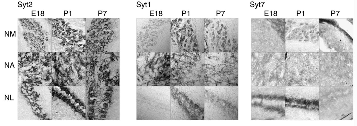 JARO_News's tweet photo. Distribution of #synaptotagmin in the embryonic and hatchling chick brainstem (Gallus gallus): MacLeod et al. took a close look at it! https://t.co/v8dpm8pPJl @UofMaryland @SynaptoKate #cochlearnucleus https://t.co/xl05KN3lcW