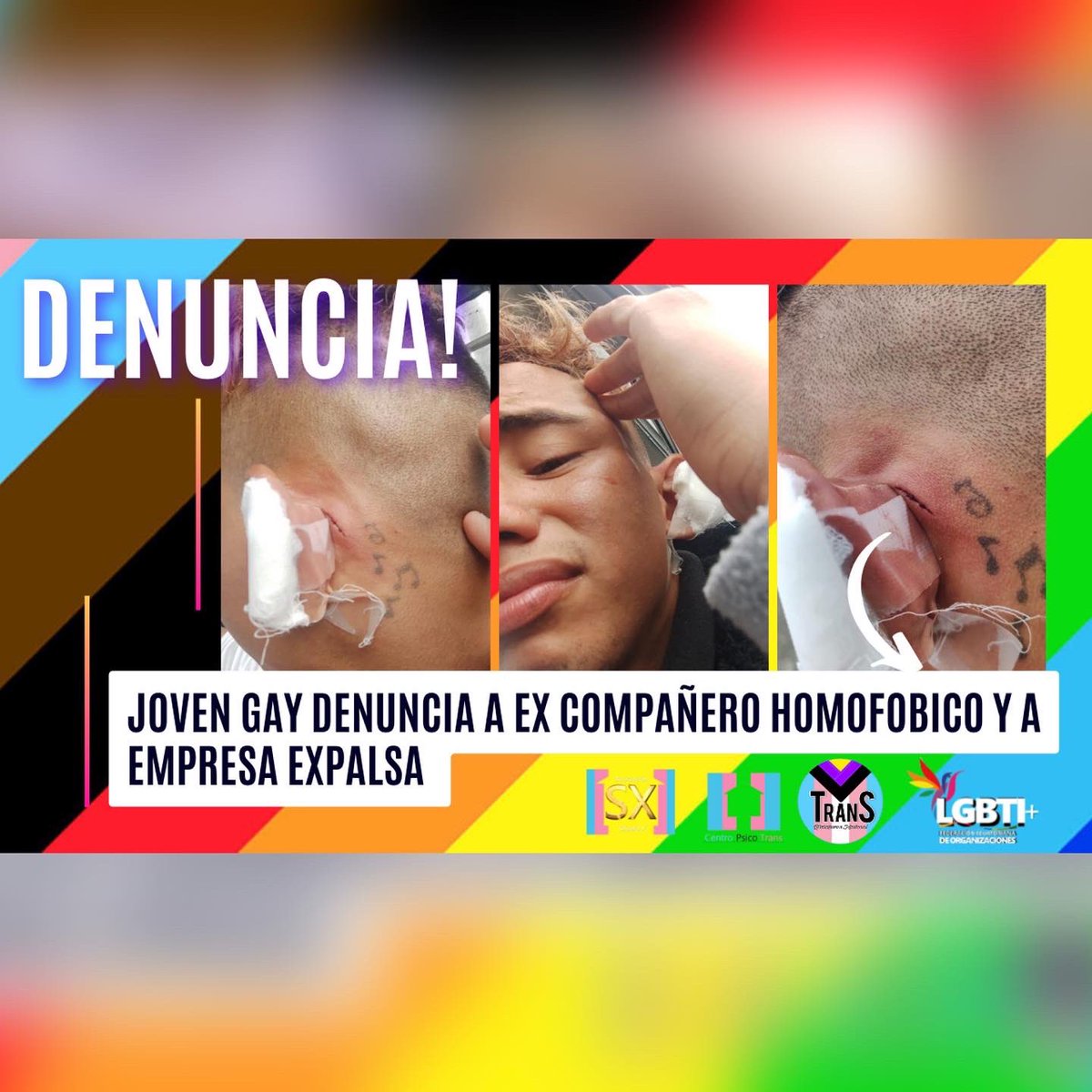 FederacionLGBT's tweet photo. BOLETÍN: Joven gay denuncia su presunta separación injusta de EXPALSA luego que un homofóbico de la empresa casi le arranca la oreja

ATENCIÓN @LassoGuillermo @MinGobiernoEc @DDHH_Ec @Paoflouj @aggmonteros @DEFENSORIAEC @MinTrabajoEc @DonosoEcuador 

@EFEnoticias @teleamazonasec https://t.co/vK6ZQjmBrT