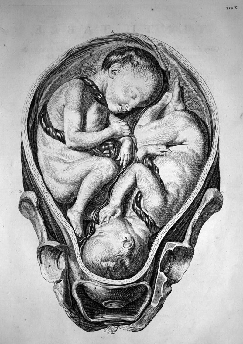 In 1613 zag in Kapelle-Biezelige een vierling het licht. Voor die tijd uniek. Immers de vier kinderen waren het gevolg van een ‘normale’ bevruchting. Hoe het daarna de vierling is vergaan blijft gissen. 

zalig-zeeland.com/zeeuwse-almana…