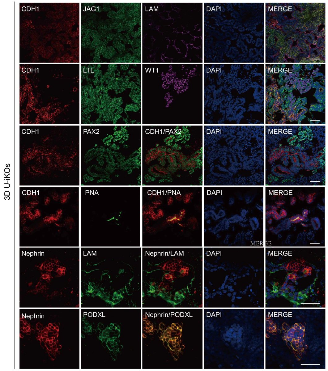 organoidscience's tweet photo. A research team 👩🔬👨🔬 out of Guangdong Provincial Institute of Nephrology generated mitochondria-rich #KidneyOrganoids via partial reprogramming of human urine cells under a defined medium 🧫.
@OACellBiology
📝 Read more: https://t.co/7djErs9t4O https://t.co/jm4pecBcPM