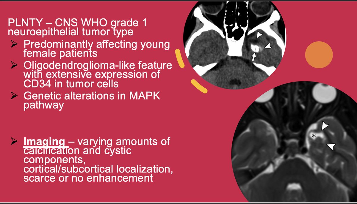 get-updated-information-on-the-2021-who-classification-of-cns-tumors-by