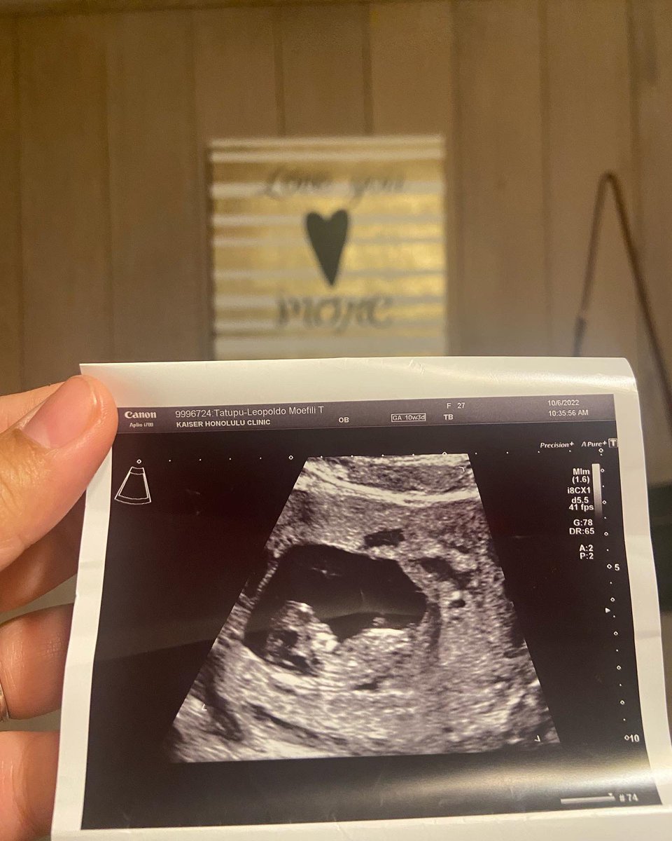 Kweenfilix's tweet photo. My baby Kings is going to be a BIG BROTHER🫶🏼🫶🏼🫶🏼 #BLESSEDx2♡ https://t.co/C5pkPECjGl