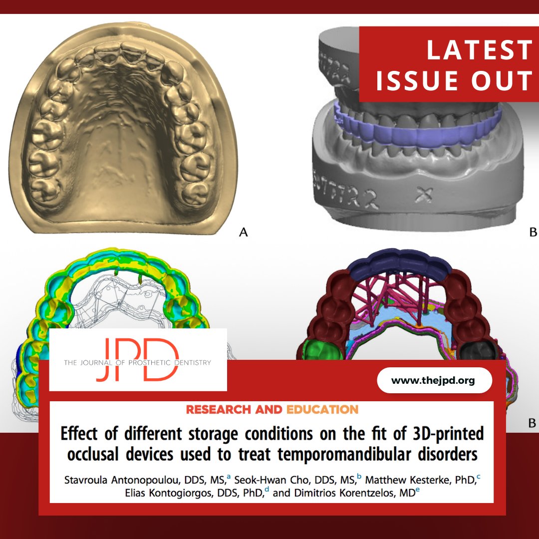 JPDentistry's tweet image. The #dimensionalstability, changes in shape and fit of #CADCAM fabricated #occlusalguards stored with and without water and light over a month period is evaluated. Learn more from the latest issue of #theJPD: thejpd.org/article/S0022-…