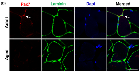 musclecellnews's tweet photo. 🎇 A fresh insight into sarcopenia with new treatment potentials!

@JCSM_cachexia features study out of @njuniversity demonstrating #atrophic #muscle fibre-derived sEV miRNA inhibits satellite cell differentiation during #aging-induced muscle atrophy.

👉 https://t.co/gwH2l18FWi https://t.co/n7TjZ6Mnhh
