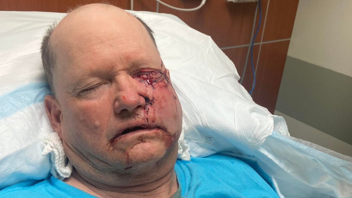 WAFB's tweet photo. PLEASE SHARE. Deputies are looking for the driver who severely beat an Ascension Parish man after a minor traffic accident. https://t.co/iAoR5SKMI4 https://t.co/IwGA72Z1RH