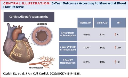Our center’s experience on the study of CAV post OHT with myocardial flow assessment with cardiac PET now in @JACCJournals Novel insights on long term risk beyond epicardial CAV Outstanding work led by #KevinClerkin @NYPCUCVI Link: jacc.org/doi/10.1016/j.…