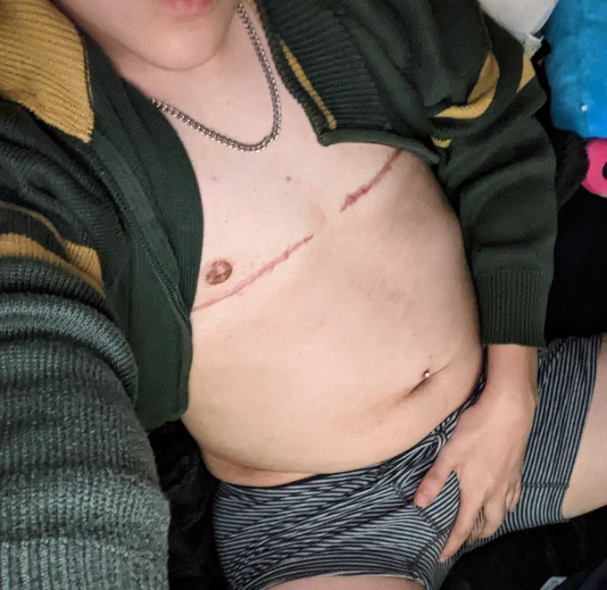 Hi #nsfw #nsfwtwt #nsfwtw #trans #transftm #ftm #transman #nude https://t.co/g6uMgosI35<a href="/tag/nsfw"class="tags">#nsfw</a><a href="/tag/nsfwtwt"class="tags">#nsfwtwt</a><a href="/tag/nsfwtw"class="tags">#nsfwtw</a><a href="/tag/trans"class="tags">#trans</a><a href="/tag/transftm"class="tags">#transftm</a><a href="/tag/ftm"class="tags">#ftm</a><a href="/tag/nude"class="tags"><span>#nude</span></a><a href="/tag/transman"class="tags"><span>#transman</span></a>