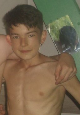 raresgaitan's tweet photo. 2) I used to be the fat kid of the group.

Playing CS:GO all day and eating shitty food.

But att 14, my life turned upside down.

I was diagnosed with anorexia.

In 10 months, I went from 75kg to 37kg.

My whole body was breaking apart and I was given a few more months to live. https://t.co/LSKHMANL2Y