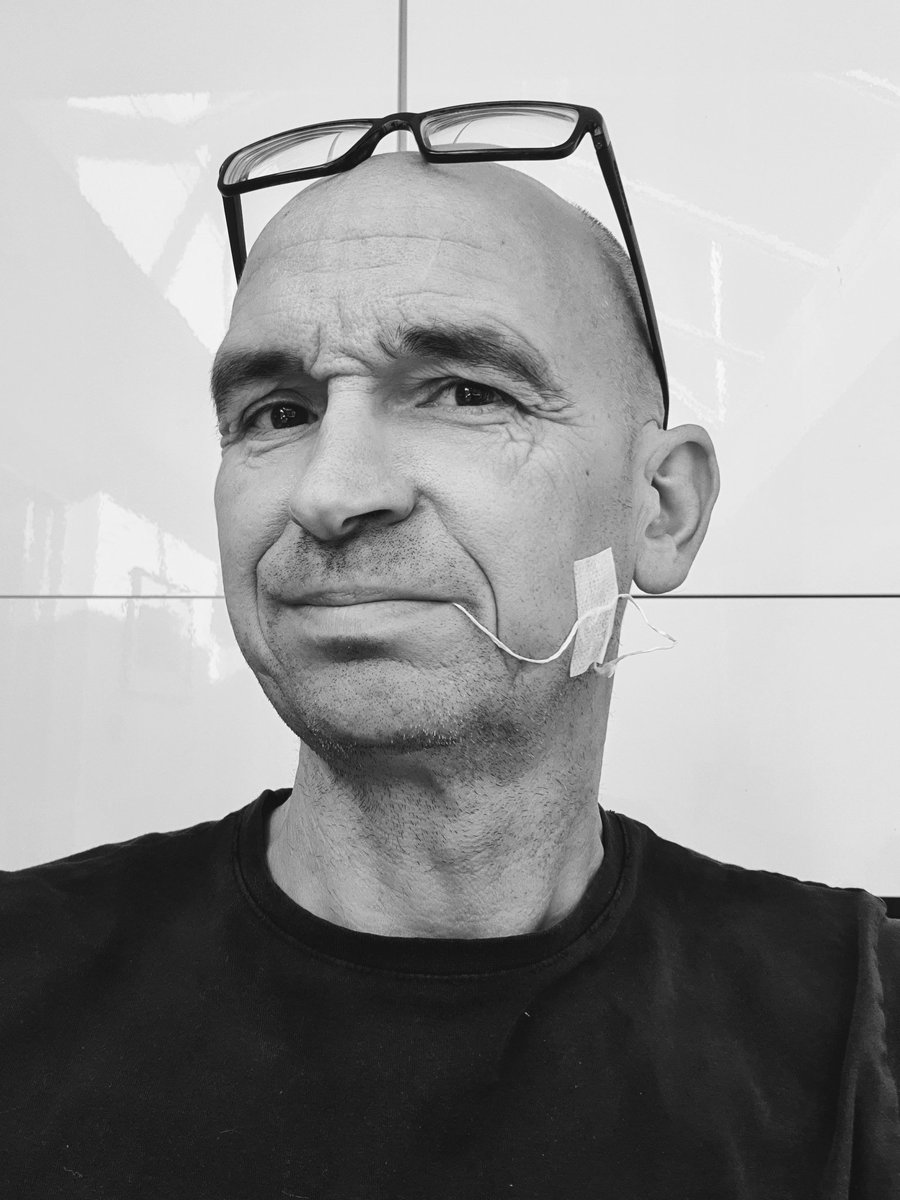 MotoNutJob's tweet image. Stringy
#WankyEsophagus #EosinophilicEsophagitus 
#StringTest (CEST)