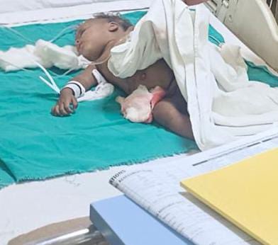 RubikaLiyaquat's tweet image. कई मैसेज आ चुके हैं।कुत्तों के काटने कि ख़बरें मायूस कर रही है..एक मासूम की आँत नोच डाली आवारा कुत्ते ने..सोसायटी में बच्चों का निकलना दूभर है। dog lover मैं भी हूँ लेकिन उस जमात से नहीं जो बच्चों की safety पर तो आँख मूँद ले और कुत्तों के हक़ के लिए सड़कों पर आ जाए @dmgbnagar