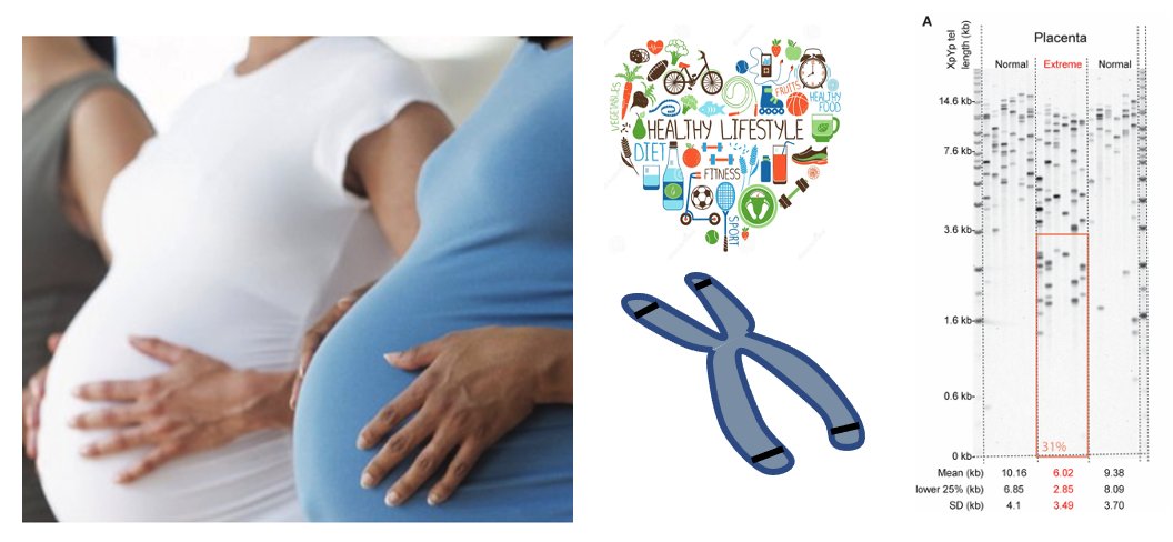 Interested in developmental origins of health and disease #DoHaD #FetalProgramming #pregnancy #StemCells? Want to study in Cardiff?  Funded PhD: "Aging before birth: identifying influences of modifiable maternal lifestyle on telomere length" swbio.ac.uk <a href="/SWBio_DTP/">SWBio DTP</a>