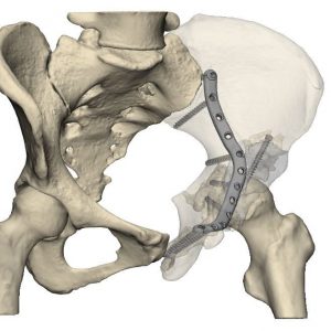 🏥El Laboratori 3D del <a href="/I3ptT/">Institut d'Investigació i Innovació Parc Taulí</a>-<a href="/parctauli/">Consorci Corporació Sanitària Parc Taulí</a> es consolida com a referent estatal en l’ús mèdic de la #impressió3D

📑Ha obtingut la llicència sanitària per fabricar guies quirúrgiques i models anatòmics per a planificació de cirurgies complexes

bit.ly/3s4P9bB