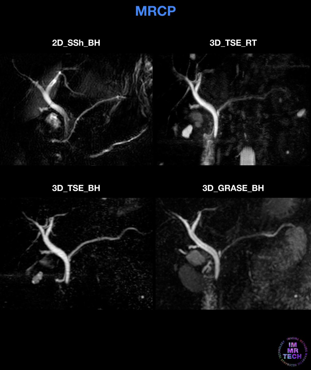 immrtech's tweet photo. Comparison between different MR CholangioPancreatography techniques. What are the differences and what kind of protocol do you usually implement for this study? Tell us in the comments below! https://t.co/yydSWzVmWk