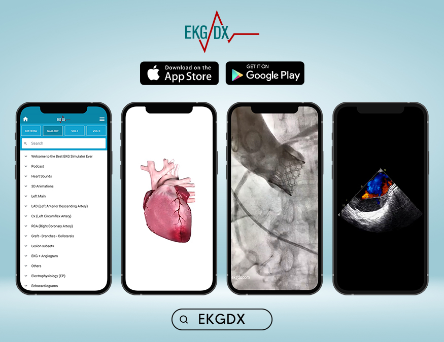 ekgdx's tweet photo. 2/ Gallery
It contains hundreds of videos of #echo, #cathlab cases (#angiograms, #PCI, #TAVI, etc), 3D animations, #podcast and much more...
The gallery is linked to #cardiotwitter (with free access to each case and full credit to the author of the post).
#radialfisrt https://t.co/MSahkDoDJX