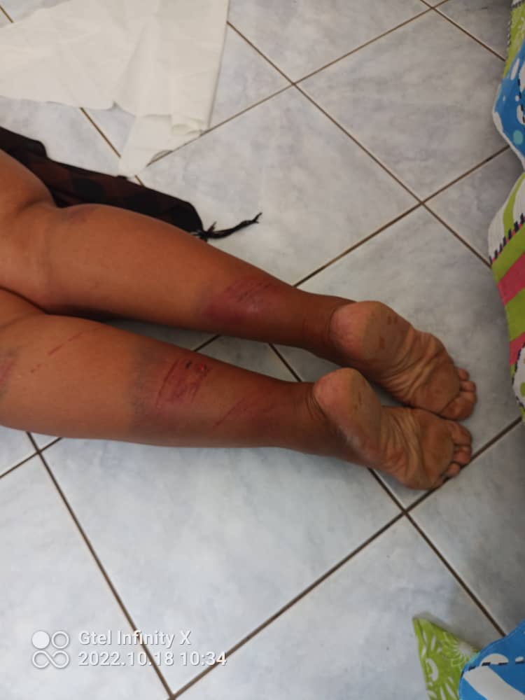 daddyhope's tweet image. A Zimbabwean opposition Member of Parliament Jasmine Toffa has authorized the publication of these pictures which show how she was violently brutalized by ZANUPF thugs in Insiza.

Zimbabwe is heading into a General election in 2023 yet the region is standing aside watching this👇🏿