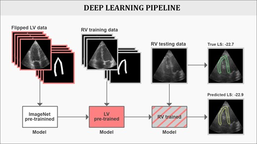 A deep learning approach for automatic echocardiographic right ventricular strain measurements

academic.oup.com/eurheartj/arti…