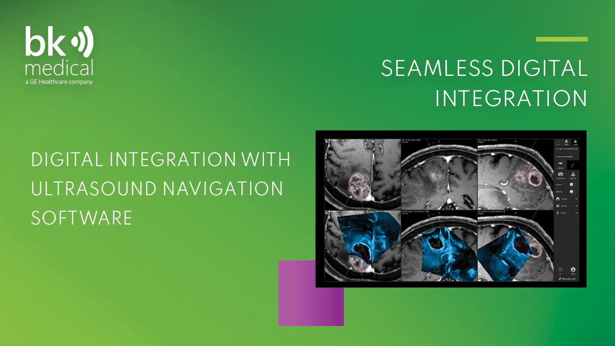 Neurosurgery - bkMedical (@neuro_bkmed) on Twitter photo Stop by #EANS2022 Booth 26 to learn about BK Medicalās digital integration with Brainlab Ultrasound Navigation software!
Learn more: hubs.la/Q01pPYFx0
<a href="/EANSonline50/">European Association of Neurosurgical Societies</a> Stop by #EANS2022 Booth 26 to learn about BK Medicalās digital integration with Brainlab Ultrasound Navigation software!
Learn more: hubs.la/Q01pPYFx0
<a href="/EANSonline50/">European Association of Neurosurgical Societies</a>