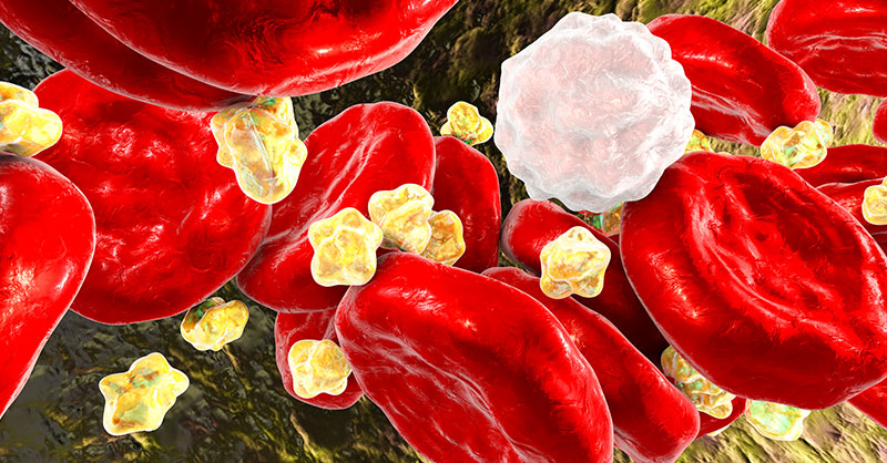 PeerView's tweet photo. Join the #HyperLipidemia experts Peter H. Jones, MD, MNLA, & @ScottWrightMD for a Live MasterClass and Practicum on #PSCK9-targeting therapies at #AHA2022! 11/7 at 6:30 AM CST (also available online at 7:30 AM EDT) https://t.co/Om9Zm2hzZc @American_Heart #Cholesterol #MedEd https://t.co/pM3cELov7N