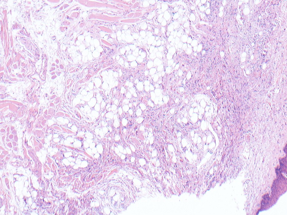 Oral Path Opinion tweet media