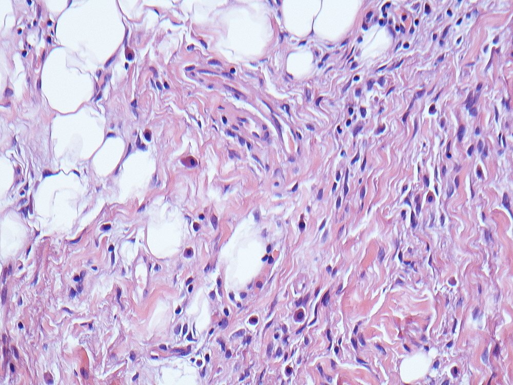 Oral Path Opinion tweet media