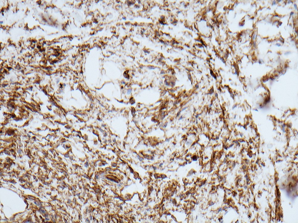 Oral Path Opinion tweet media