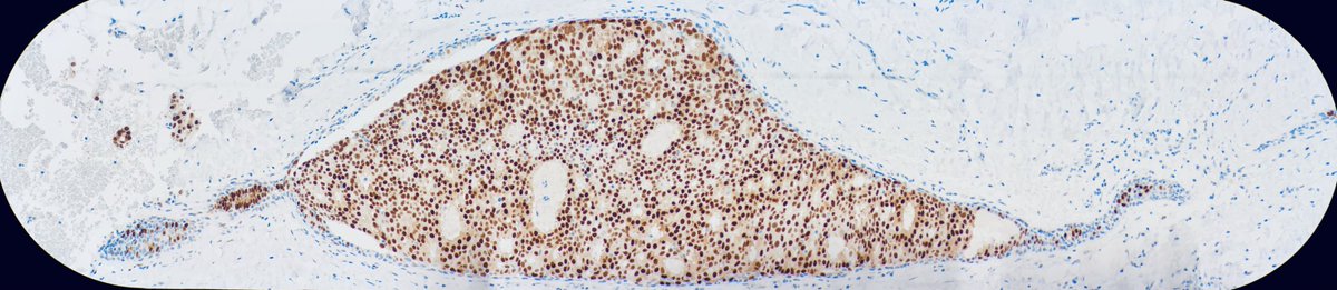pathoramic's tweet photo. A boa constrictor digesting an elephant
#PathTwitter #pathmeme #BreastPath https://t.co/YtQh3Jk5lM