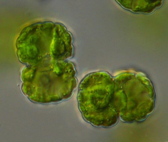 KDumack's tweet photo. Would you have expected to find #Cosmarium #greenalgae in #polar, #arctic #soils? #Algae are always in for a surprise! We did not yet sequence it yet, but I am excited to see the results. Next step: We will find out which #protists feed on it! https://t.co/eqZ8Q95Fta