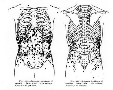 rbarbosa91's tweet photo. For those of you familiar with the 'survivorship bias' bomber graphic:  there is also a similar diagram for gunshot wounds to the abdomen.

This is from a British surgeon in 1917 (WW1) who notes that those who reached the hospital were more likely to have wounds on the sides. https://t.co/mUJGpvrEQF