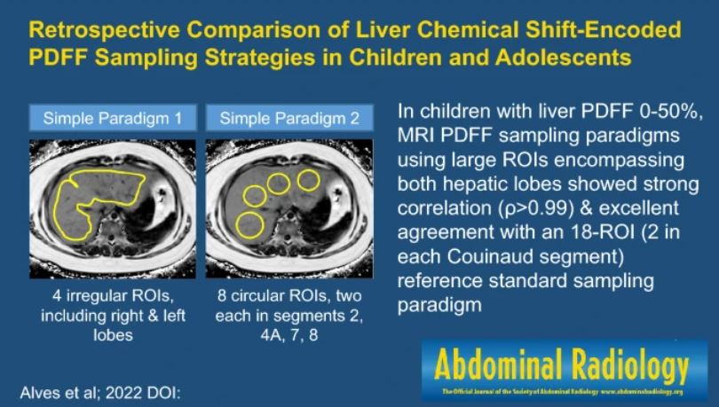 Abdominal_Rad's tweet image. Graphic abstract published 7/21/2022

#abdradJ #radiology #imaging

Retrospective comparison of liver chemical shift-encoded  PDFF sampling  strategies  in children  and adolescents

Viniciusde Padua V. Alves et al

ow.ly/ugqq50KOERV