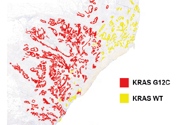 2 #PhDs in our group <a href="/ICR_London/">The ICR</a> <a href="/CEC_ICR/">Centre for Evolution and Cancer, ICR</a> 

Are you a #maths #modeller interested in cancer genomics and metastasis evolution? icr.ac.uk/media/docs/def…

Or are you a #immunologist keen to develop new tech to map T-cells in situ in cancer? (with <a href="/BennyChain/">Benny Chain</a>) icr.ac.uk/media/docs/def…