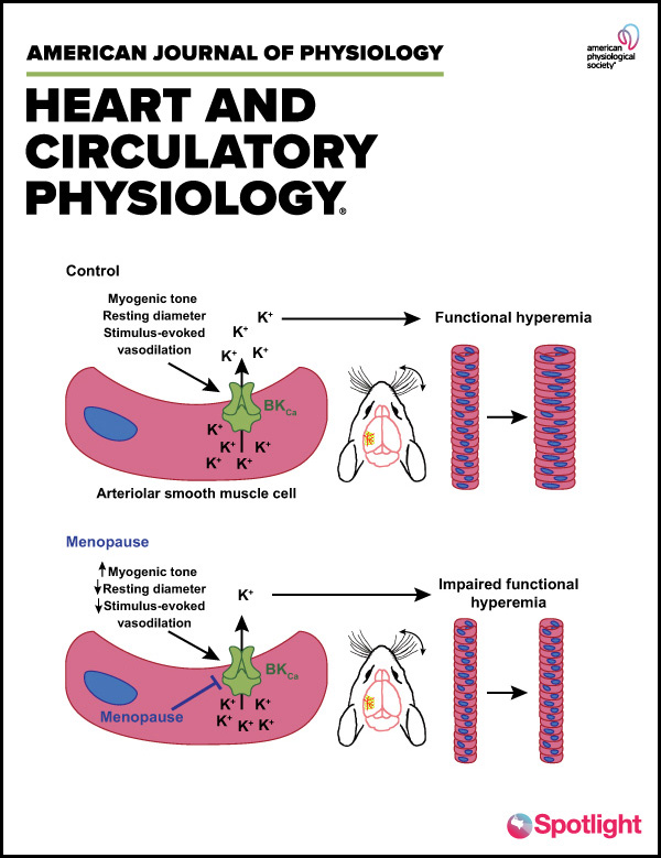APSPublications's tweet photo. Cerebral arteriolar and #neurovascular dysfunction after chemically induced #menopause in mice (Blackwell, @emmlouiss @Pires_Lab, @AJPRenalEIC et al. @uarizona) - new in @ajpheartcirc with Spotlight Cover!

https://t.co/YWt4sGUBcX https://t.co/f83oJNSf2J