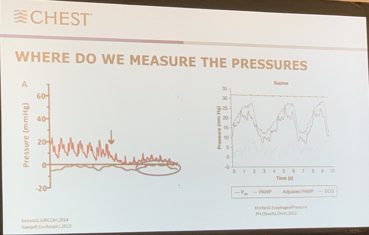 RaedDweikMD's tweet photo. Dr. @FSotoMD gives an outstanding talk in getting a good wedge pressure in PH evaluation #CHEST2022 referencing the great work by Dr. Adriano Tonelli (NOT-Y: not on twitter yet) and @GhalebKhirfan @ClevelandClinic @CleClinicMD #CleClinicLungs @CCF_PCCM https://t.co/rMUkO2GtfT